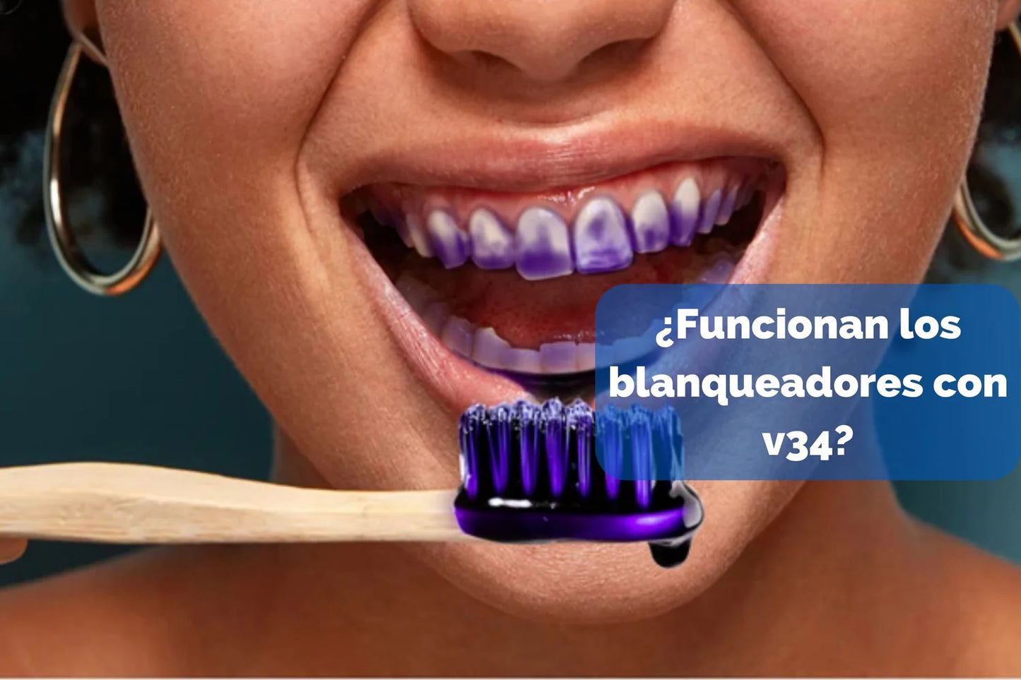 BLANQUEADOR PROFESIONAL ULTRA V