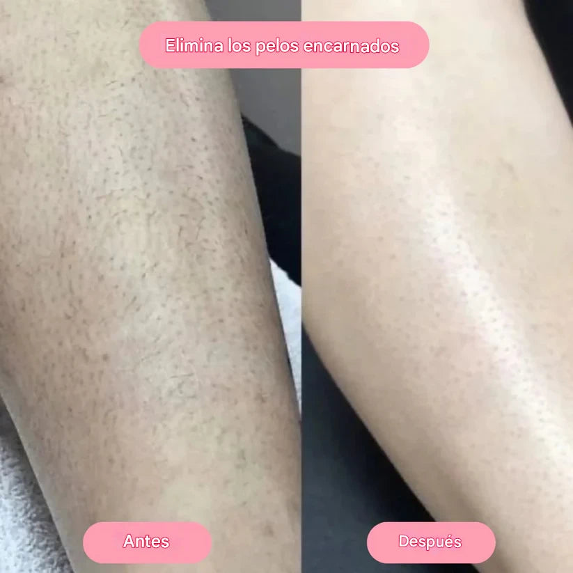 SkinPro | Tu piedra de cristal para una piel lisa y sin esfuerzo