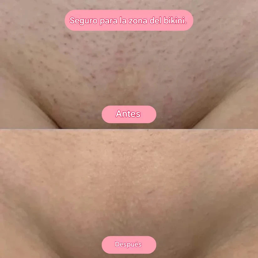SkinPro | Tu piedra de cristal para una piel lisa y sin esfuerzo