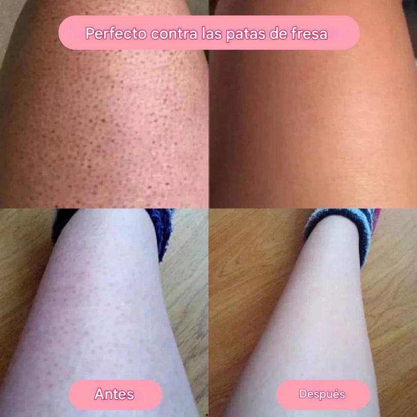 SkinPro | Tu piedra de cristal para una piel lisa y sin esfuerzo